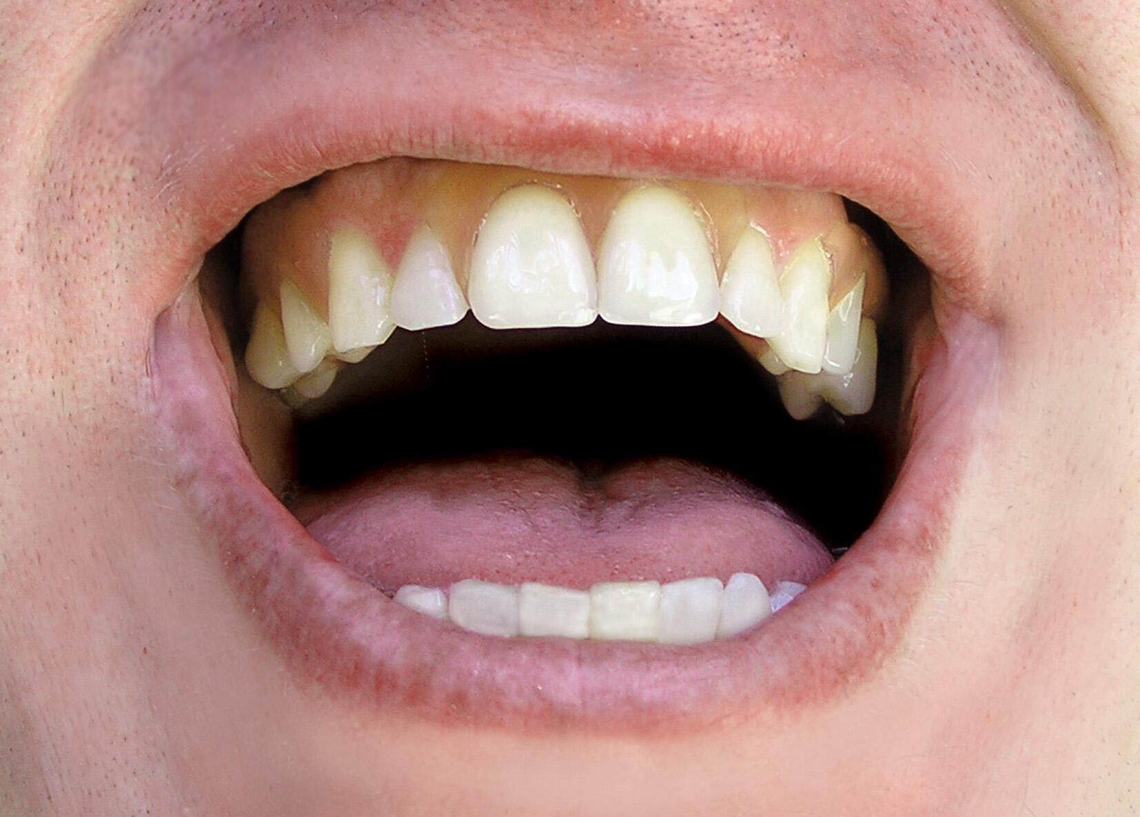 Neutral Bay Denture Care Clinic Neutral Bay Nextdoor